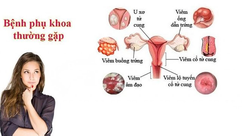 Mất kinh nguyệt là dấu hiệu bệnh phụ khoa