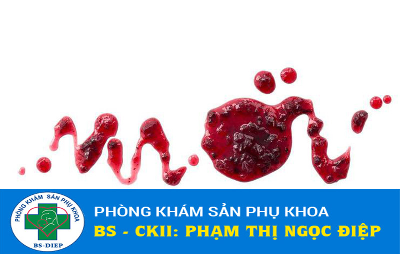 Dấu hiệu sảy thai