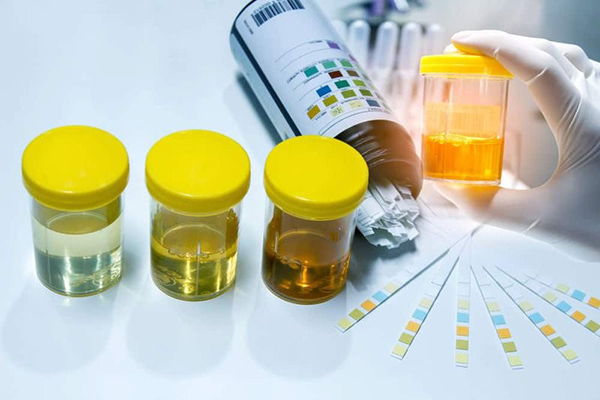 Các phương pháp mà ba có thể khám sàng lọc trước khi mẹ mang thai