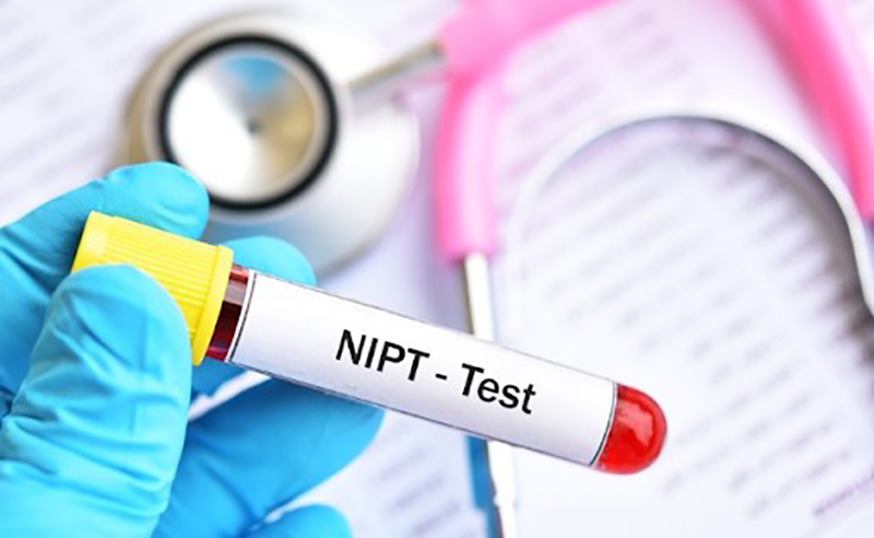 Xét nghiệm NIPT