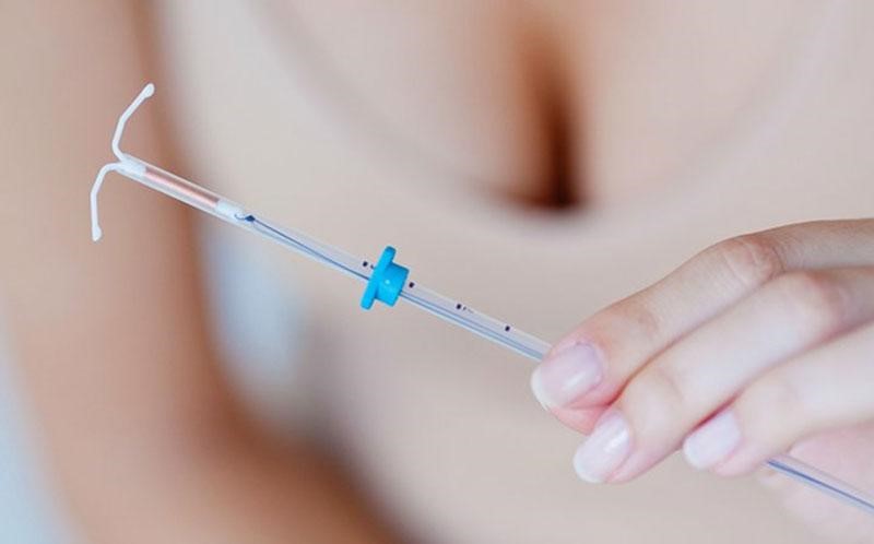 Thực hiện thủ thuật đặt vòng tại Sản phụ khoa Từ Dũ Bác sĩ Điệp