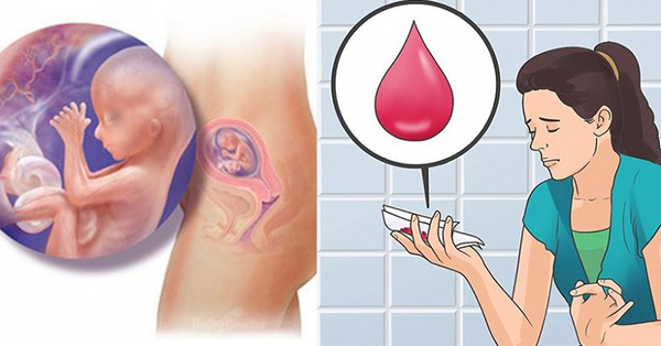 dau-hieu-say-thai-5-tuan-dau Dấu hiệu sảy thai 5 tuần đầu