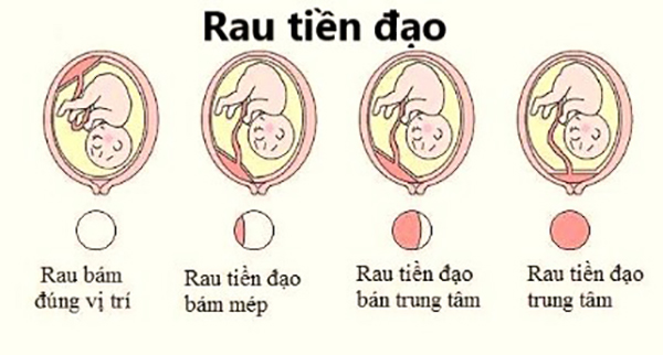 Đừng chủ quan rau tiền đạo