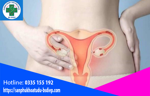 Nguy cơ bị lạc nội mạc tử cung