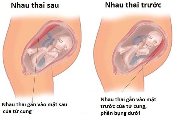 Nhau bám mặt trước