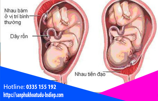 Rau tiền đạo