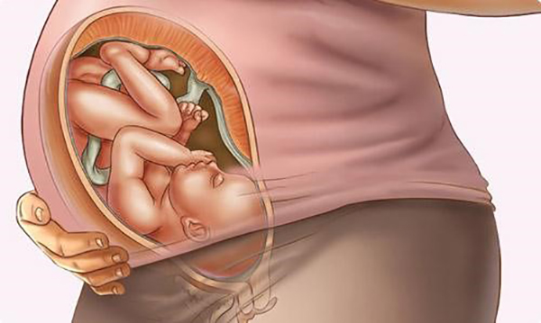 Thai nhi 38 tuần mổ được chưa