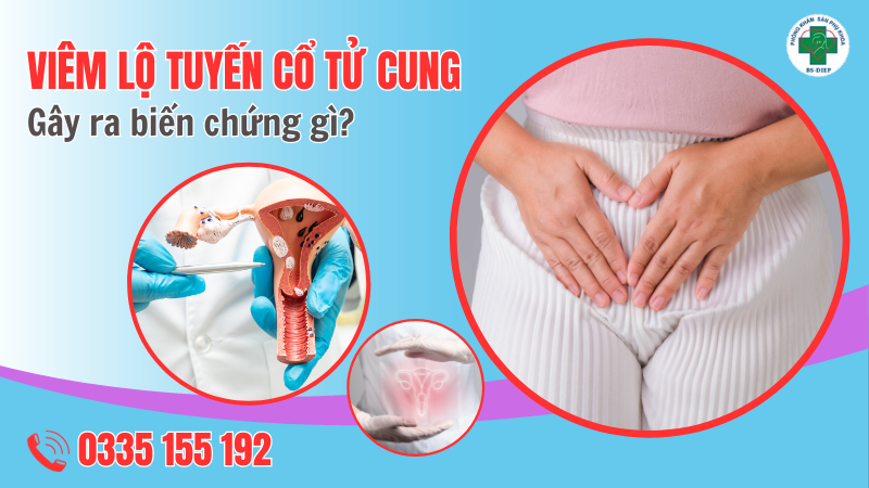 viêm lộ tuyến có nguy hiểm không?